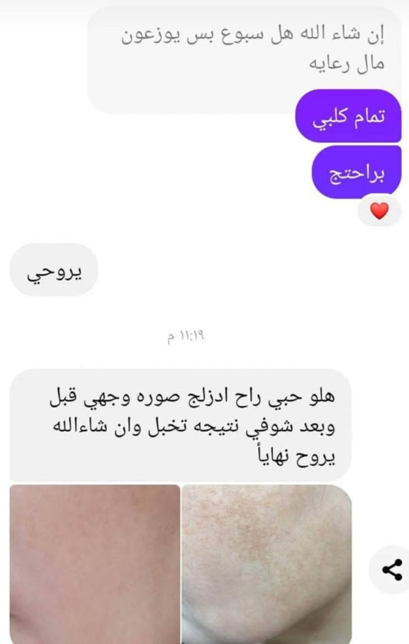 بكج كلف او تصبغات تجارب الزبائن


**إذا كنت صاحب هذا الإعلان وتريد حذفه لأي سبب، رجاءا أرسل رسالة إلى الدعم الفني**