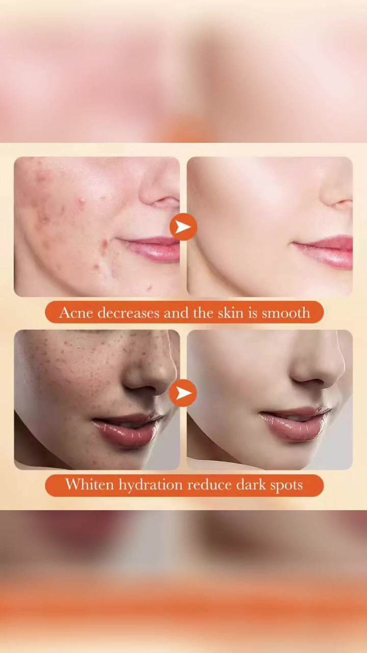 لوشن Sadoer Oats Amino Acid Soothing Lotion (لوشن سادور المهدئ بالأحماض الأمينية والشوفان).
✅يحتوي على 98% من الأحماض الأمينية المشتقة من الشوفان. 

✅مصمم للترطيب اللطيف وتنعيم البشرة وشدها. 

✅آمن للاستخدام أثناء الحمل للمساعدة في تقليل ظهور علامات التمدد. 

✅يساعد على تبييض البشرة وترطيبها وتغذيتها.

الحجم 100ml


**إذا كنت صاحب هذا الإعلان وتريد حذفه لأي سبب، رجاءا أرسل رسالة إلى الدعم الفني**