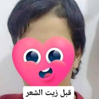 زيت إنبات شعر • تطويل شعر • نتايج رهيبة