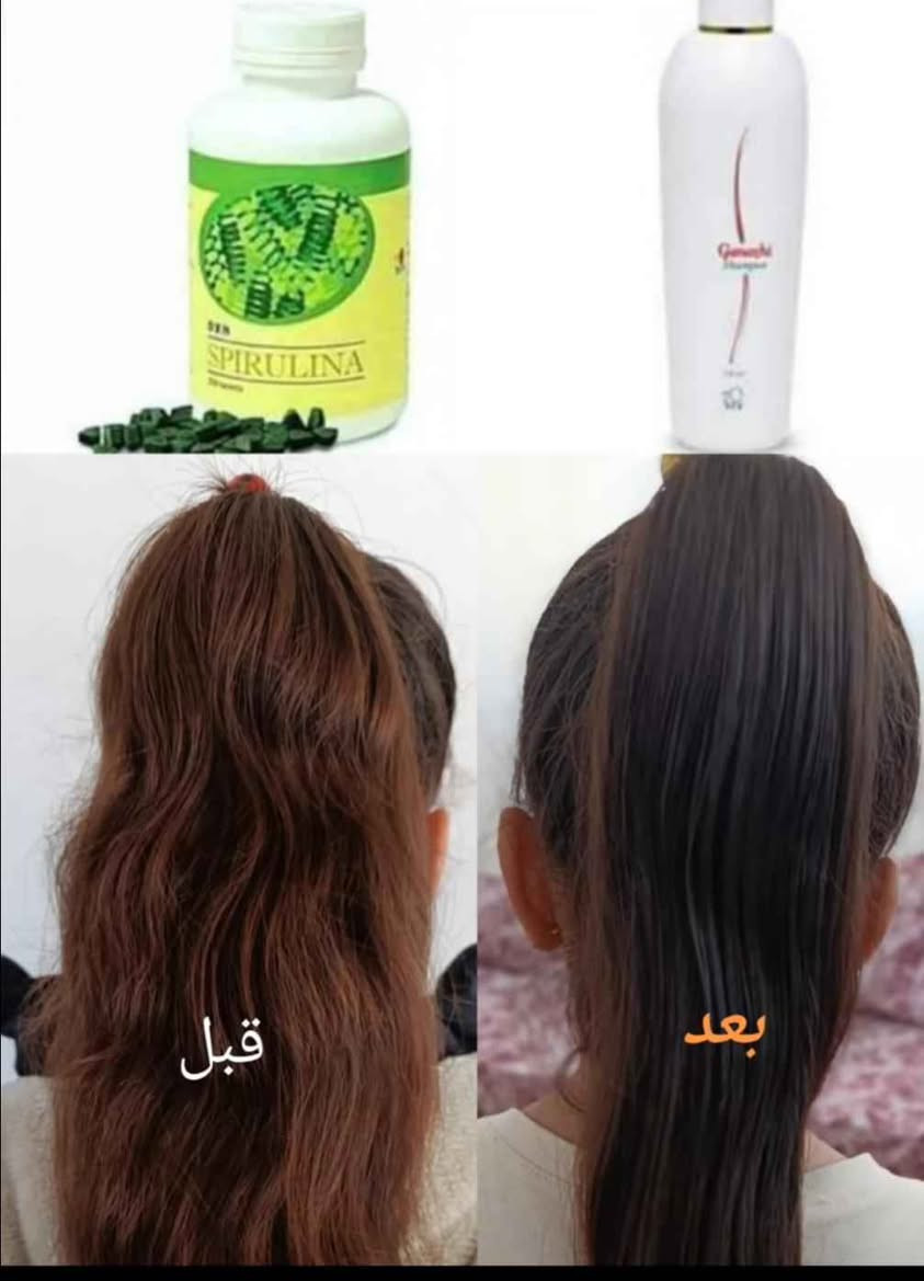 منتجات صحيه طبيعيه امنه 100/100🫧🫰🏻🌿 كربلاء, العراق


**إذا كنت صاحب هذا الإعلان وتريد حذفه لأي سبب، رجاءا أرسل رسالة إلى الدعم الفني**