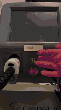 من يلتقي العلم بالراحة… يولد الجمال بلا ألم. ✨
جلسات إزالة الشعر بالليزر جهاز الكانديلا الثلجي (  لمار للتجميل والرشاقة )  مجمع الثريا الطبي
تبريد ذكي يسبق النبضة، دقة تحترم البشرة، ونتائج تُرى وتُحس.

لا حرق، لا قلق، فقط نعومة تدوم أكثر مما تتوقعين.
لأن بشرتج تستحق تقنية تُعاملها بلطف… ونتيجة تقول: جان القرار صحيح 

احجزي جلستك اليوم، ودعي البرودة تشتغل لمصلحتج ❄️💗
📍 مجمع الثريا الطبي / شارع الاطباء /طويريج 
رقم الحجز : *********** 
#الليزر
#الكانديلا
#طويريج
#تجميل
#تجميلي
