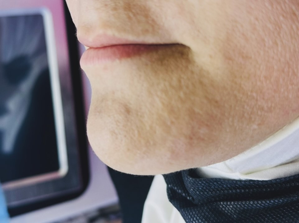 #احلى فيلر 
طبعا والله التصوير كولش يضلم النتائج بالحقيقه تجننن ❤️🔥🔥👌


**إذا كنت صاحب هذا الإعلان وتريد حذفه لأي سبب، رجاءا أرسل رسالة إلى الدعم الفني**