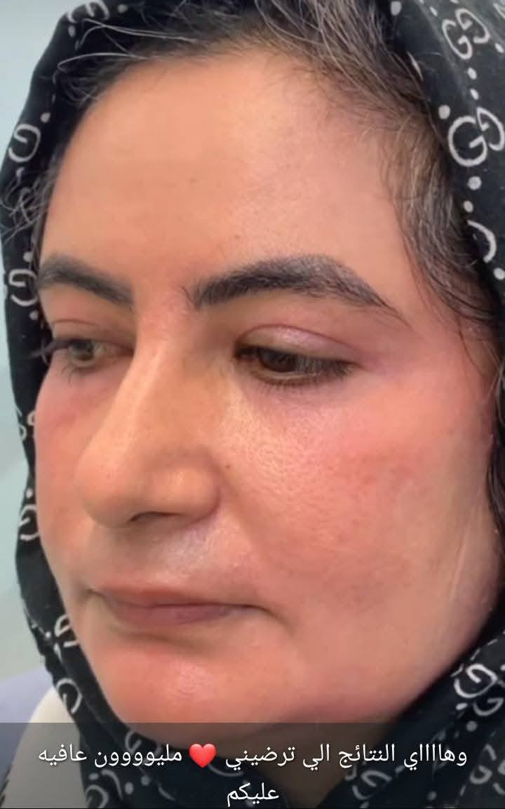 وبلشنا عروض العيد 

حتى كلكم تلحكون تحلون مشاكلكم 

الي يحب يستفسر ع عروض يتفضل ع خاص 
🌷


**إذا كنت صاحب هذا الإعلان وتريد حذفه لأي سبب، رجاءا أرسل رسالة إلى الدعم الفني**