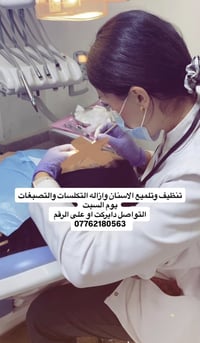 تنظيف وتلميع الاسنان ازاله التكلسات والتصبغات قلع الجذور التالفه التسب...