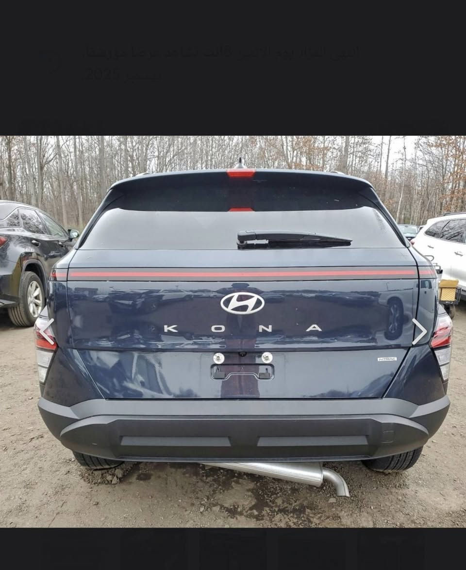 السلام عليكم كونا موديل 2025 السياره مكفوله فقط دعاميه مبدله صور الحادث مرفوقه بالمنشور  السياره جديده مابيه اي نفص كامله السياره بدون رقم مكاني بابل *********** وبيه وتساب السعر 170 وبيه مجال
