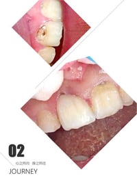 حشوة ضوئية • بعقوبة • صيدلية الغيث