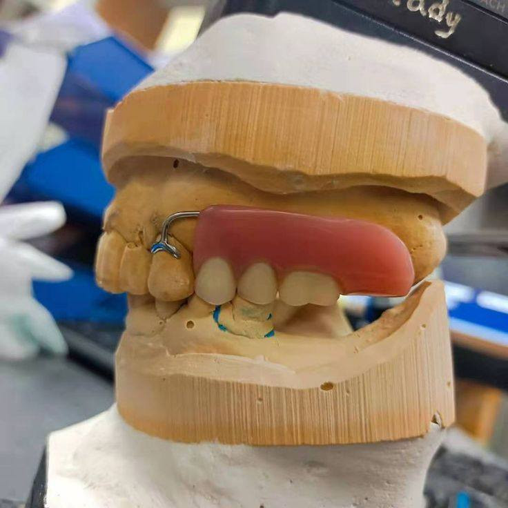 فاقد اسنانك وتريد تعوضهن؟!
بكلية طب الاسنان جامعة بابل نعوضهن الك بشكل مجاني 💸
كل الي عليك تنوي تحجز وتلتزم بالموعد 👍🏻📝
وخلال 4 جلسات راح يصير عندك طقم اسنان جاهز تلبسه بكل ايامك✨💓

احجز على الواتس ***********
او على ماسنجر الصفحة 🤝
الاربعاء ساعة 11 تنفتح العيادة
