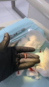 خدمات طبية مجانية • قلع أسنان • كربلاء السعدية