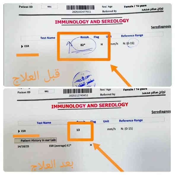 تتواجد كل يوم ثلاثاء مساءً 

#العنوان الحويجه /شارع الاطباء مجمع الحكمه الطبي 
الفرع الثاني مقابيل مجمع القمه الطبي 
للحجز والاستفسار ***********
متواجدين واتساب ***********
