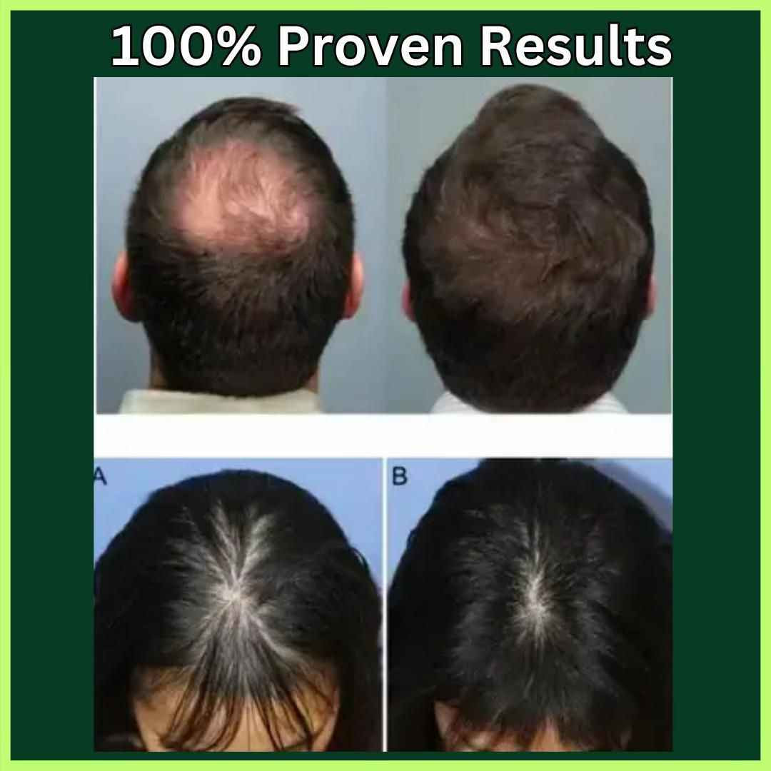 108 عشبة هندية.. يعني الحل الجذري لكل مشاكل الشعر! 🇮🇳✨
ليش زيت Adivasi مختلف عن أي زيت ثاني بالسوق؟
لأن تركيبته فريدة وتتكون من 108 عشبة طبيعية صافية! 🍃
يعني دتنطين شعرج فيتامينات ومعادن وعلاجات مكثفة بلمسة وحدة.
✅ يعالج الصلع الوراثي والتساقط الكربي.
✅ يثخن الشعرة ويمنع تكسرها.
✅ يطول الشعر بفترة قياسية.
✅ يرجع الحيوية للشعر التالف والمحروق.
دللي شعرج بخلاصة الطبيعة.. 💆‍♀️

صنع في الهند النجف, العراق


**إذا كنت صاحب هذا الإعلان وتريد حذفه لأي سبب، رجاءا أرسل رسالة إلى الدعم الفني**