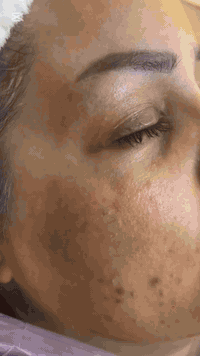 تنظيف بشرة • جلسة وجه • حله/جامعة بابل