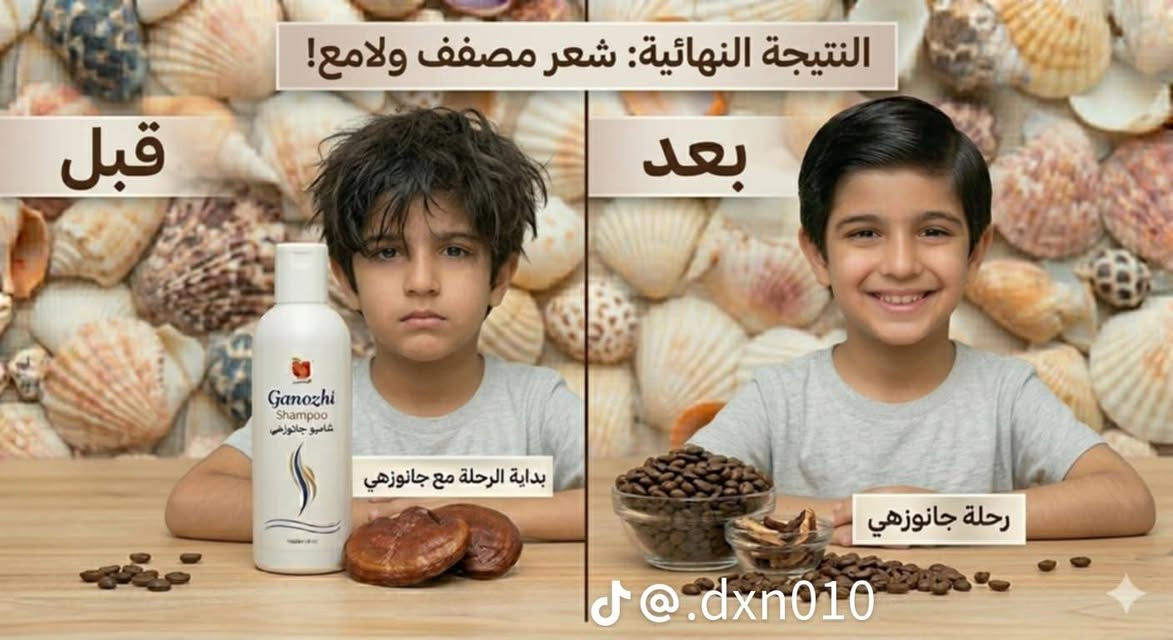 شامبو جانوزي
#شامبو #جانوزي #شركة #dxn #لشعرلامع_وصحي


**إذا كنت صاحب هذا الإعلان وتريد حذفه لأي سبب، رجاءا أرسل رسالة إلى الدعم الفني**