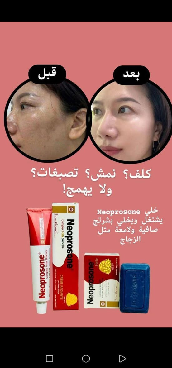 الكلف مزعجج؟ النمش مضايقج؟ خلي Neoprosone يرجّعلج صفاء بشرتج يقلل التصبغات، يفتح اللون، ويخلي الوجه صافي مثل الحليب يتكون من عصاره +صابونة 💯💯

♦️. كريم نيوبروسون المشهور عالميا 
Neoprosone Forte 
منتج امن و مجرب ومضمون وماركة عالمية
مكوناته اعشاب امنة على البشرة وعلاجية دائمية قبل متكون تجميلية 
علاج طبي بامتياز
🌟 اهم المميزات 🌟
✔احسن علاج لتفتيح وتبيض البشرة
✔معالجة للكلف والنمش 
✔معالجة للاكزمة والطفح الجلدي والحكة والتحسس 
✔معالجة للتصبغات الجلدية والبقع والاسمرار
✔معالجة اثار حب الشباب واسمرار الشمس 
✔خالي من الكورتزون 
✔خالي من الزئبق 
 💡افضل منتج للكلف ولإسمرار البشرة وتقشر الجلد الخارجي وتبيض البشرة وتفتيح لونها👍

♦️. صابونة نبريسون :: Neoprosone
مبيضة لبشره بصورة سحريه 
تخلصك من حب الشباب نهائياً 
علاج للنمش 
علاج للكلف 
علاج للهالات السوداء 
 اعشاب طبيعيه ونباتات طبية 💯
🚘يوجد خدمة توصيل لجميع محافظات العراق 🚘


**إذا كنت صاحب هذا الإعلان وتريد حذفه لأي سبب، رجاءا أرسل رسالة إلى الدعم الفني**