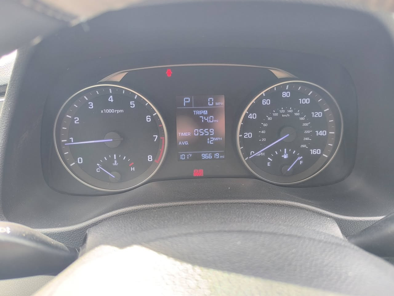 للبيع: النترا 2017 وارد أمريكي 🇺🇸
الموديل: 2017
الوارد: أمريكي
المواصفات: نص فل
الكير : أوتوماتيك

الحالة:
حادث سابق (بوند)
جاملغ (شاصي مدفوع فقط )
كير ومحرك شرط ✔️
طخم تاير جديد كوري الاصلي
رقم اربيل 

السعر 125 
الموقع موصل 

للتواصل(***********1) (***********)
