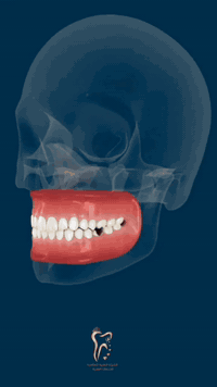 طب الأسنان • تعويض الأسنان • طويريج