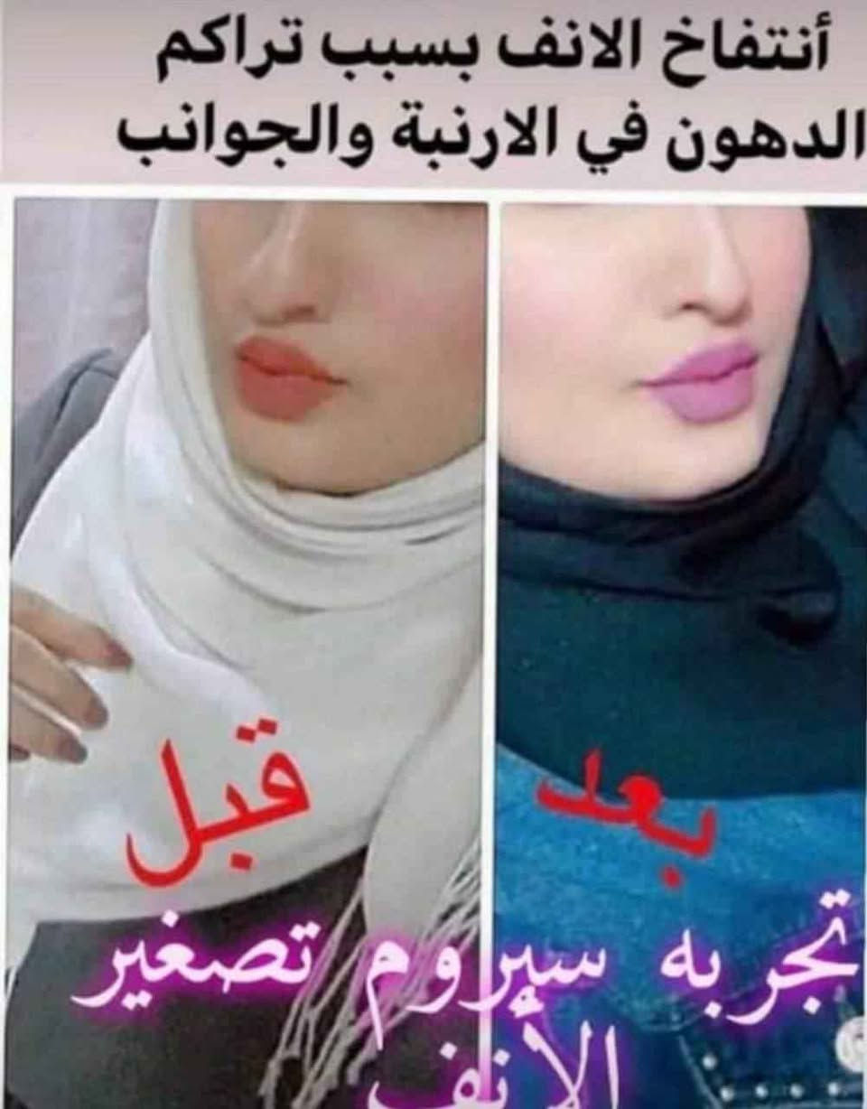 سيرم + تقويم لتصغير الانف الاصلي 💯
لكثرة الطلبات وتجارب كورس تصغير الانف من قبل زبائنه وفرنا الكم مرة لخ ♥️♥️

للحصول على انف مثالي وبدون عمليات جراحية وتكاليف باهضه مع عرض تصغير الانف 
يتكون من 
سيروم تصغير انف من شركة
water ice levin
سيروم لتصغير الانف بدون عمليه بفتره قصيره وداخل المنزل
يتم استخدامه من خلال وضع قطرات من سيروم التنحيف العشبي ع منطقه الانف مع مساج بسيط وينصح بارتداء تقويم الانف للحصول ع نتائج مبهره وسريعه حجم السيرم 10ملم👃

جهاز تصغير الأنف👃
الجهاز مصنوع من السيليكون ويقوم بعملية تقويم الأنف تماماً مثل جهاز تقويم الأسنان.
الجهاز يعمل على شد غضروف الأنف وإعادة تشكيلها من جديد بدون ألم.
طريقة الاستخدام: 
للحصول على النتائج المرغوبة يستخدم الجهاز يوميا 15 دقيقة لمدة 10 أيام وستلاحظون الفرق بنفسكم
الصنع /كوري

سعر العرض سيروم + تقويم  30الاف 
🚘 يوجد خدمة توصيل لجميع محافظات العراق 5 الاف 🚘 بغداد, العراق


**إذا كنت صاحب هذا الإعلان وتريد حذفه لأي سبب، رجاءا أرسل رسالة إلى الدعم الفني**
