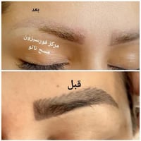 مسح تاتو • نتايج سريعة • شارع الهوره