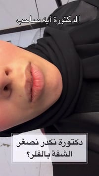 الديوانية • فلر شفايف • فلر سويسري