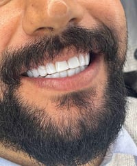 ابتسامة ما تنسى لكل الأعمار! ✨ بسعر مغري جدا لفترة محدوده  جلسة سريعة،...