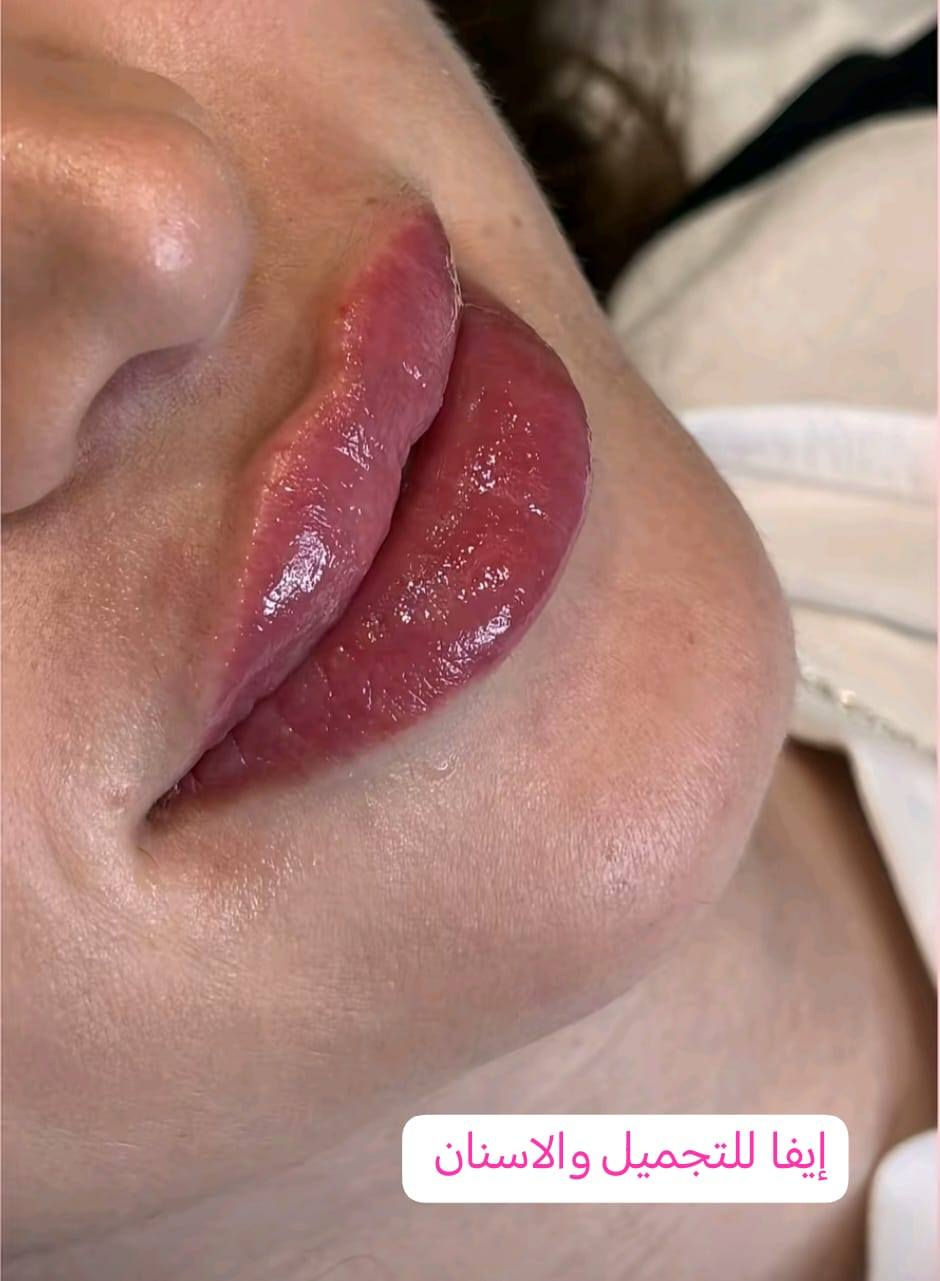 السيسي الواحد 25 الف
مدينة الصدر الكياره قطاع٦٧ مقابل نادي الجولان عيادة ايفا لتجميل الوجه والأسنان


**إذا كنت صاحب هذا الإعلان وتريد حذفه لأي سبب، رجاءا أرسل رسالة إلى الدعم الفني**