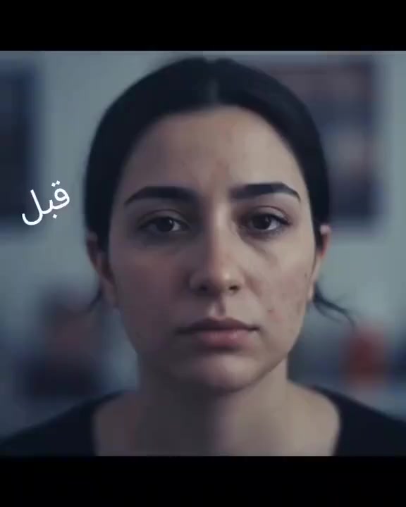 الكولاجين البحري من شركة ايدمارك الماليزيه متوفر خدمة توصيل مجاني كل محافضات العراق ومتوفر في اغلب الدول العربية وغير العربيه


**إذا كنت صاحب هذا الإعلان وتريد حذفه لأي سبب، رجاءا أرسل رسالة إلى الدعم الفني**