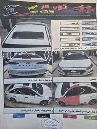 سوناتا سبورت • ٢٠١٨ • ٨١ الف