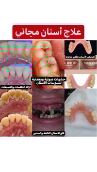 الي محتاج تنظيف أسنان، حشوات، قلع خلي يتواصل وياي على الواتساب 0788703...