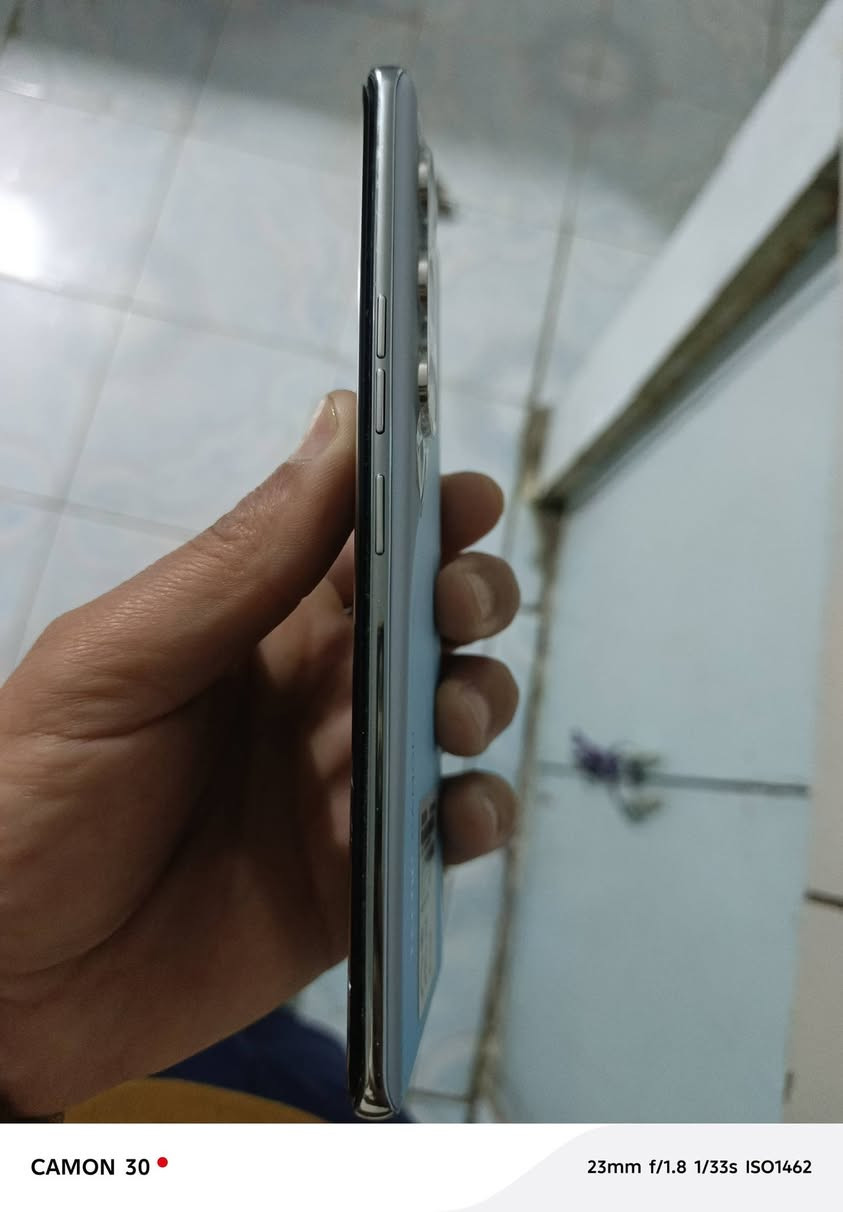 سلام عليكم جهاز تكنو كامون 40برو 5g ذاكرة 256 جهاز نضيف ٩٩/بلميه الجهاز لا مصلح ولا شي سعرة ٢٥٠ الف قفل مكاني بغداد الدورة للتواصل خاص


**إذا كنت صاحب هذا الإعلان وتريد حذفه لأي سبب، رجاءا أرسل رسالة إلى الدعم الفني**