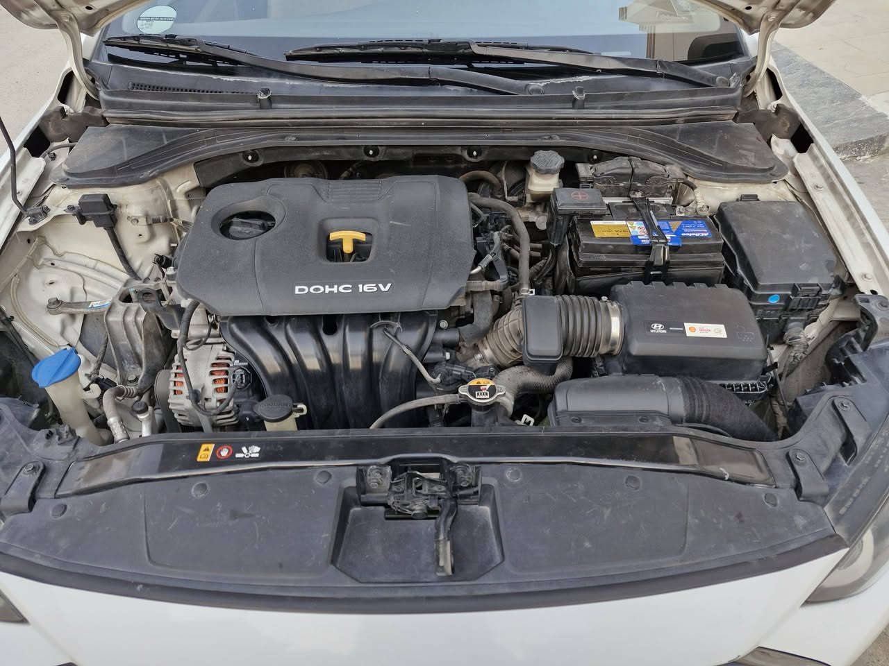 السلام عليكم النترا موديل ٢٠١٧ (jls) خليجي مكفولة عدى جاملغ بارد امامي جهة السايق وشخط مكحل باب عكس سايق ول ٢ مبينات سيارة جديدة على أيدي من جانت ماشية ١٨ الف سبير منازل صدر جديد وسيرفس جديد ٢ سويج شخاطة مال شركة تبريد تدفئة كاملة مدوشمة أرضية وصندوق جلد وكشن مخمل هسه ماشية١٤٤ الف رقم بغداد جديد بسمي تحويل ثاني يوم الي يحب يشتري الاتصال علرقم (***********) ورجاء الي يشتري اتصال مباشر لاخاص ولامراسلة السيارة في الطوبجي سعرها ١٤٧ وبيها مجال بسيط
