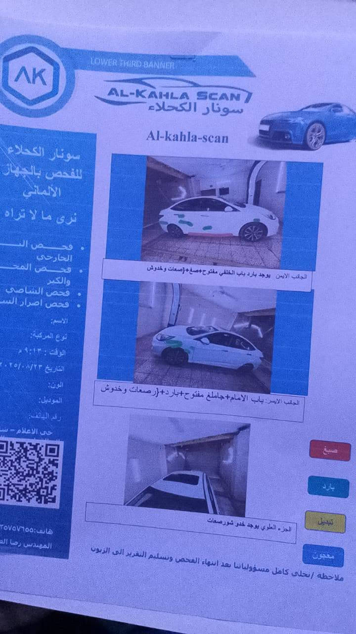 هونداي اكسنت ٢٠١٦ مواصفات بيه تبديل بنيد دون دواخل السياره خير من الله  محرك وكير مكفولات  جاهزه من كلشي السعر /105وبيها مجال/ ***********
