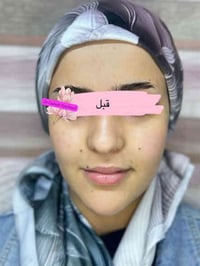 تغيير شامل بسيط السيسي الواحد 25 الف   مركز ايفا الطبي 💉🦷  ‏‪077308378...