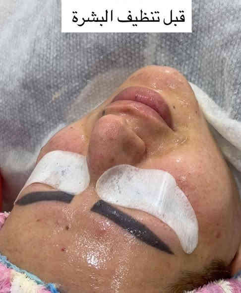 #يلااااا_جاهزين 🔥

#عروض_رأس_السنة 🎄❄️🎅🏻

نستقبلكم بكل حب يومياً 💜🤍💜

⏰ من الساعة 10 صباحاً الى الساعة 8 مساءاً
يوم الجمعة من الساعة 11 ظهراً الى 9 مساءا

للحجز والاستفسار :- 
مراسلة الصفحة أو 
📱***********
◾️◾️◾️◾️◾️◾️◾️◾️◾️◾️◾️◾️◾️◾️◾️
‎🏠 العنوان: بغداد_الاعظمية_شارع الاخطل_فرع حديقة الاخطل قرب مدرسة صرح النعمان الاهلية
