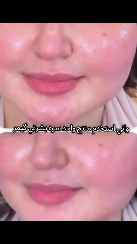 "البنات اللي جربوها ما عاد يستغنون عنها.. شوفي رأي الزبائن قبل وبعد استخدام خلطة عراق كوين

عناية_بالبشرة #تفتيح_البشرة #خلطات_تبييض #بشرة_صافية #كلف_ونمش #تفتيح_الجسم جمال خلطات_طبيعية


**إذا كنت صاحب هذا الإعلان وتريد حذفه لأي سبب، رجاءا أرسل رسالة إلى الدعم الفني**