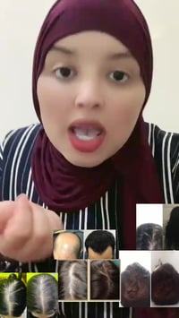 تساقط الشعر • زيت طبيعي • شعر كثيف