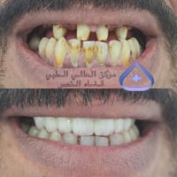 مركز طبي • تجميل أسنان • ذي قار قضاء النصر