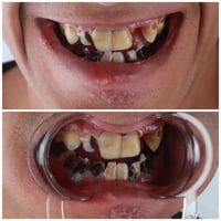 زراعة فورية • تركيبات تجميلية • حي الحضارة