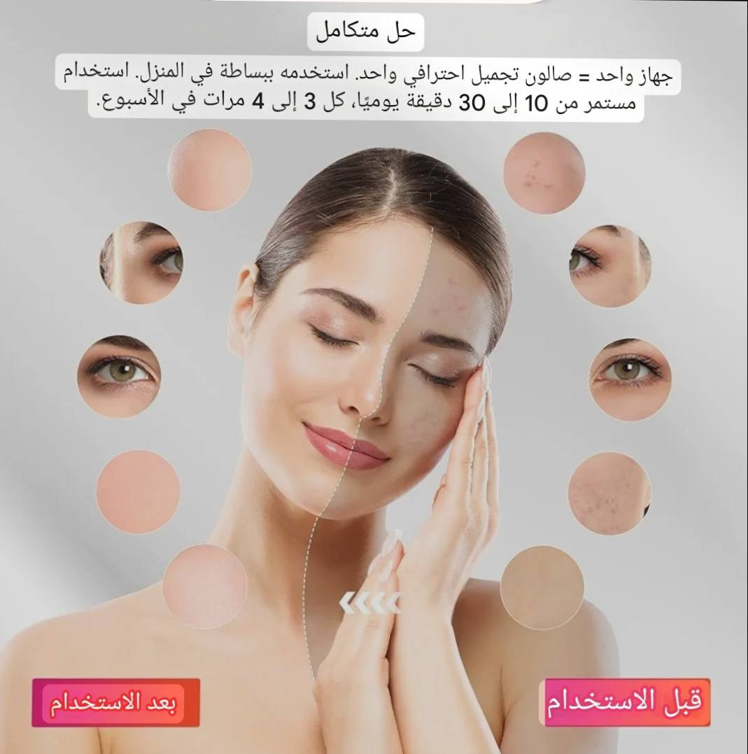 حبايب اجهزه نضاره على 15,القطعه والتوصيل مجاني للي ياخذهم كلهم ***********
