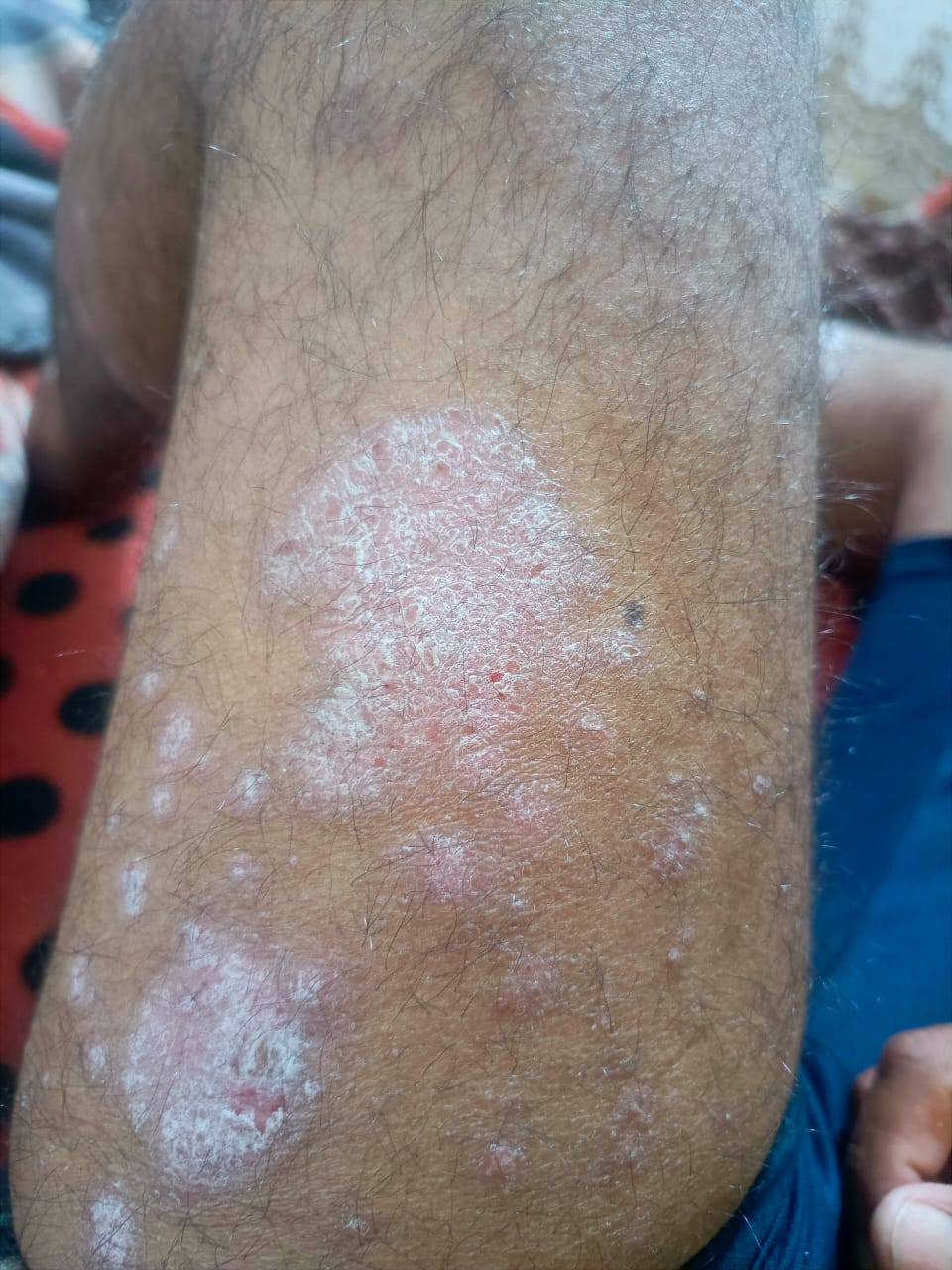 ببركه محمدوال محمديوجدعلاج للصدفيه وداء السمكه خادمكم سيد سلام الموسوي *********** عمارة, ميسان
