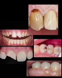 الي عنده مثل هاي الحالات يراسلني اعالجها مجانا 07802888723