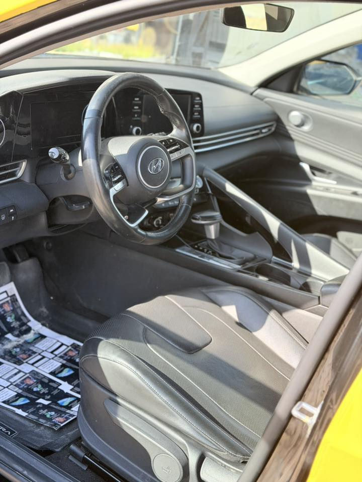 السلام عليكم النتره مديل ٢٠٢٢ هايبرد سونارها بل منشور مكانها مدينه الصدر  سعرها 150وبيه مجال الاستفسار  ***********
