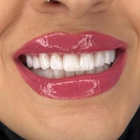 "ابتسامتك هي سر جاذبيتك، دعنا نساعدك لتكون مشرقة دائماً."  متواجدين لخ...