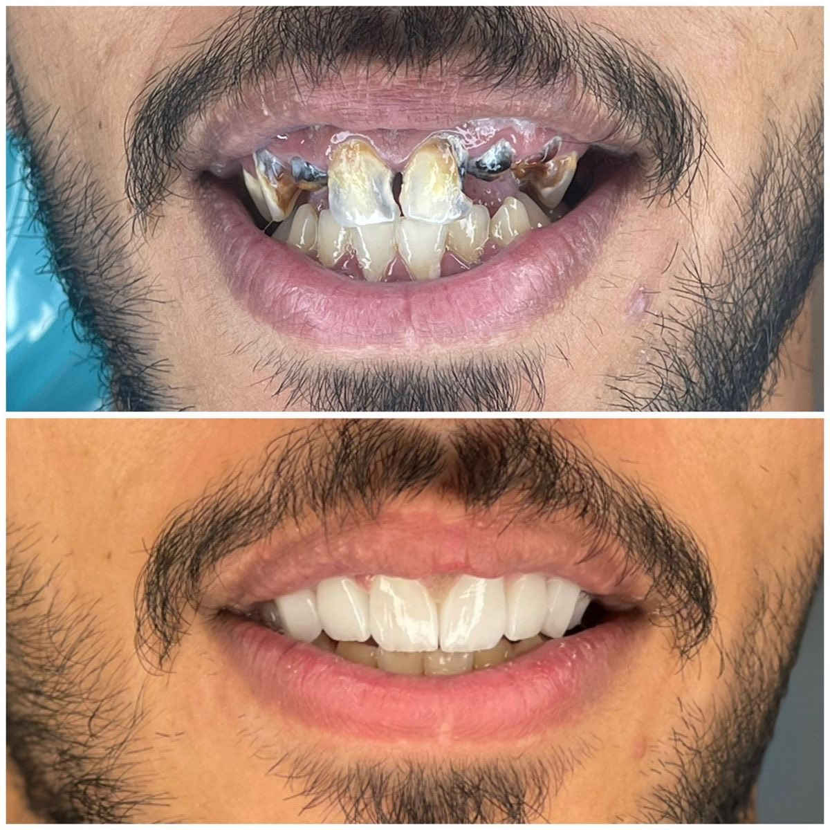 صحة أسنانك هي مفتاح ثقتك بنفسك،لذلك يمكنك الاعتماد علينا في الحفاظ على صحة اسنانك.
راعي اسنانك بشكل مميز من خلال الحجز ،
علماً ان العلاج مجاني.
العنوان: الكرادة _ ساحة الاندلس_ عيادات جامعة الاسراء
***********✅
