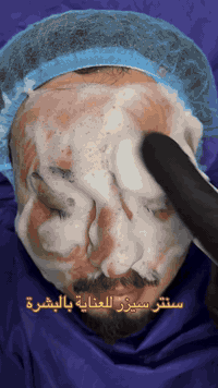 هايدروفيشل • عناية بالبشرة • حجز مسبق