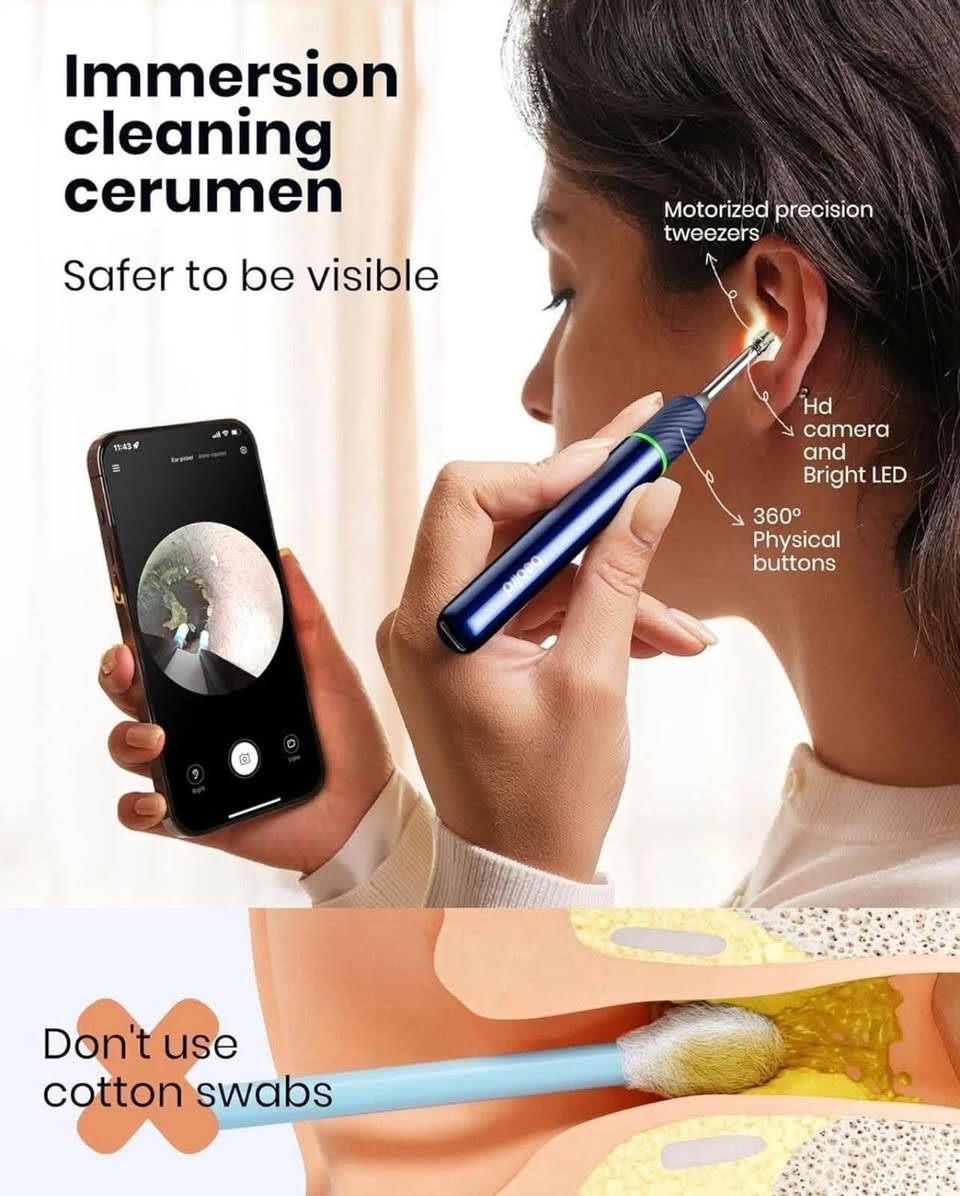 جهاز كاميرة دقه فول اج دي لتنظيف الاذن
للبيع جهاز العناية الشخصية وتنظيف الأذن الذكي Curego X17 Pro Max الأصلي، الجهاز جديد تماماً وغير مستخدم (مغلف بغلاف المصنع) 💯.أبرز مواصفات ومميزات الجهاز:📸 كاميرا HD بدقة 1080p (8 ميجابكسل): تمنحك رؤية واضحة جداً وتفصيلية داخل القناة السمعية عبر الهاتف مباشرة.🌐 اتصال لاسلكي ذكي: يربط بسلاسة مع جميع هواتف الأندرويد والآيفون عبر تطبيق خاص وبث مباشر سريع.💡 إضاءة LED مدمجة: مصابيح LED قوية لإنارة تامة ومريحة أثناء الاستخدام.⚖️ جيروسكوب ذكي: تحكم دقيق وثبات تام للرؤية أثناء تحريك الجهاز.🌡️ تحكم ذكي بالحرارة: آمن ومريح للجسم لتجنب أي إزعاج داخل الأذن.📦 الملحقات: يأتي مع قاعدة شحن ذكية ومجموعة ملاعق سيليكون طبية مرنة وقابلة لإعادة الاستخدام والغسل.حالة المنتج: جديد 100% مغلق بالكامل
السعر ٢٥٠٠٠


**إذا كنت صاحب هذا الإعلان وتريد حذفه لأي سبب، رجاءا أرسل رسالة إلى الدعم الفني**