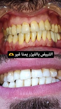 عيادة ابتسامة • جلولاء • عمارة صيدلية الطليعة