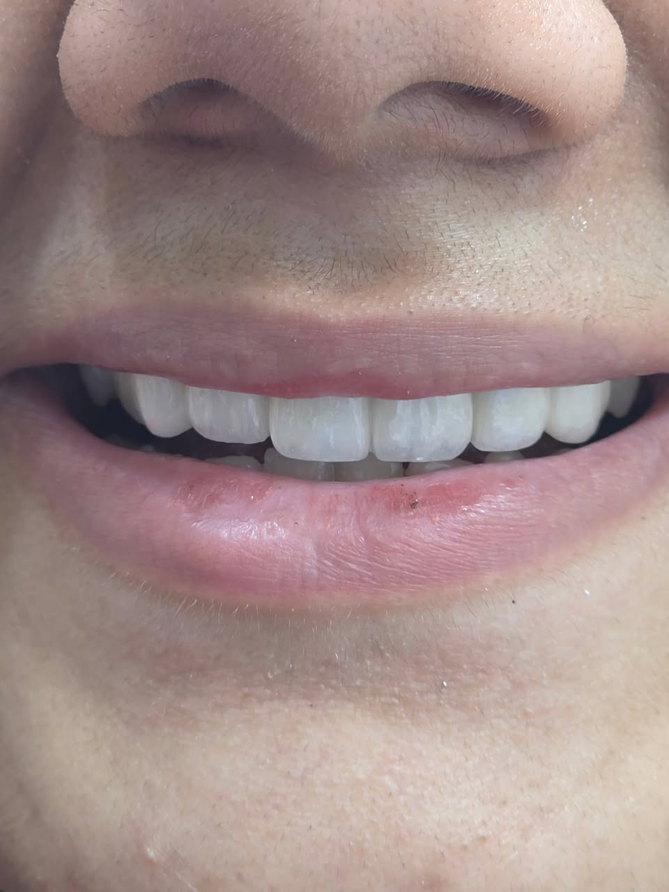 الجمال الحقيقي هو الذي يجمع بين الصلابة والواقعية؛ في مركز الوارث، تيجاننا وجسورنا تُهندس بدقة فائقة لتمنحك أداءً قوياً ومظهراً طبيعياً يفيض بالفخامة
من اعمال طبيبنا المتميز 🫡
محمد سخي

📍 متواجدين يومياً طول أيام الأسبوع:

📞 للتواصل ويانه:
✅ العيادات البشرية: ‎***********
✅ عيادات التجميل: ‎***********
✅ عيادات الأسنان: ‎***********

📍 العنوان: الناصرية – شارع بغداد، مجاور مدرسة الجواهري الأهلية
