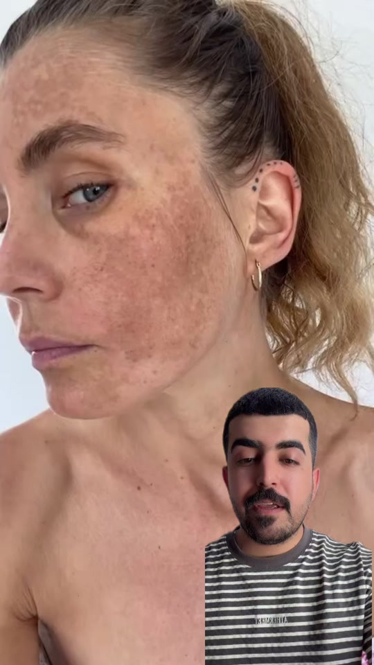 


**إذا كنت صاحب هذا الإعلان وتريد حذفه لأي سبب، رجاءا أرسل رسالة إلى الدعم الفني**