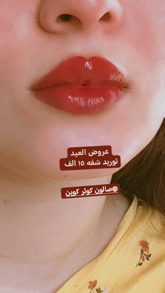 الدوام من ساعه الواحده الظهر لحد الساعه ٥ العصر
و وره الفطور من ساعه ٨ لحد الساعه ١١ بالليل
عروض عروض عروض ❤️‍🔥❤️‍🔥❤️‍🔥❤️‍🔥❤️‍🔥
السلام عليكم  العنوان الجديد بنات 
فلكه سويب شارع السايدين مقابيل قاعه الزهراء قرب الوكيله ام واثق  لافته ورديه مكتوب عليها كوثر كوين نفس صوره الصفحه مال صالون 
  كل الهلا بيكم بنات تنوروني
رقم الصالون  *********** واتس اب
ميش شعر ٢٥ الف
صبغ شعر ١٠ الاف
حفافه وتنظيف بشره ١٠ الاف
تنظيف بشره ملكي بالهايدرو وقناع الاوبرا وماسكات اصليه ١٥ الف 
اكرليك ٢٥ الف كل اثنين الثالثه بنص السعر
جلش ١٠ الاف
تركيب رموش ١٥ الف كل اثنين الثالثه بنص السعر
تركيب رموش طرفيه ١٠ الاف
تاتو ٢٥ الف
حرف وشم ٥ الاف
تنظيف قدم ٧ الاف
جلش قدم ٨ الاف
تسريح شعر قصير ٤٠ وسط ٦٥ طويل ٩٥ حسب كثافه وطول الشعر
