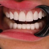 اوتار كلينك • ابتسامة هوليود • الشموخ