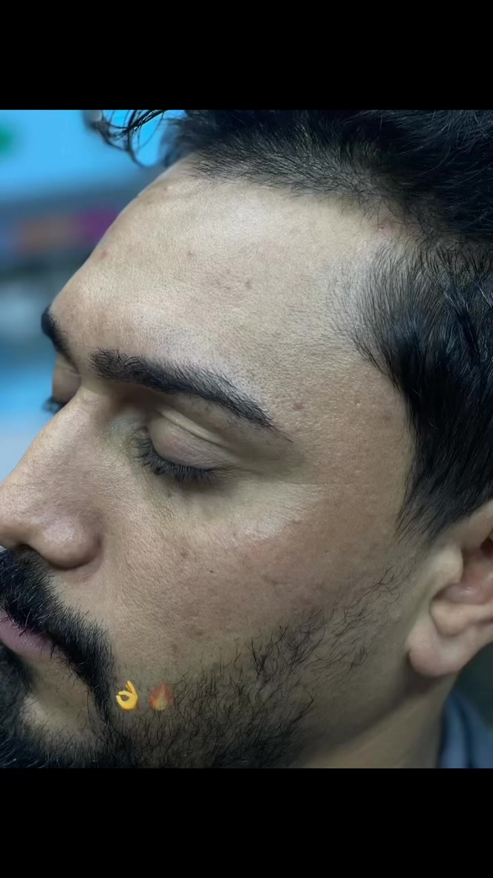 موافقه ادمن جزاك الله خير 🤍
بدت عروض العيـــد 🎉 والخصم لكل مايخص البشره من تنضيف هايدروفشل تنضيف ملــكــ👑ــي معالجه تجميل تغير شامل حقن ابره النضاره جلسات ديرمابن لمعالجه  البشره من العيوب الكلف التصبغات معا نضاره بياض  تصفيه كله متوفر يمي  كل مايخص جلسات وعمل المراكز متوفر بـ اسعار كلش مناسبه 

ام قصر شارع 8 ركن مقابيل موكب ابو هادي 
الماكيـــر حسيـــن. للتواصل. ***********
